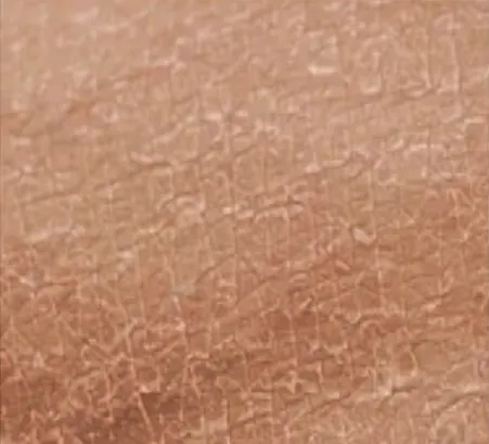 Kulit kering dan bersisik sebelum memakai Body Serum