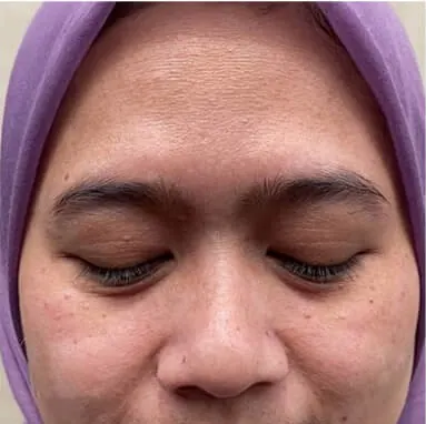 Wajah pengguna pada Day 1