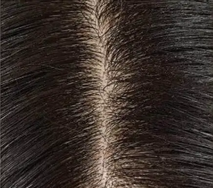 Belahan rambut yang sama tampak lebih lebat sesudah memakai Therapy Serum